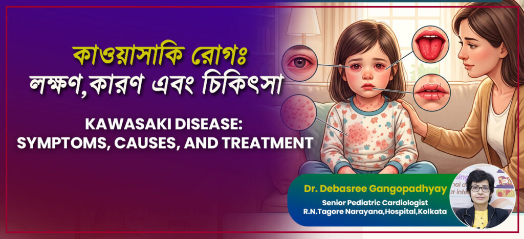 কাওয়াসাকি রোগ - লক্ষণ, কারণ, রোগ নির্ণয়, চিকিৎসা (Kawasaki Disease: Symptoms, Causes & Treatment Options)